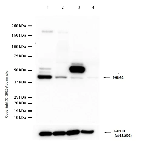 Western blot - Anti-PHKG2 antibody [EPR9727] - BSA and Azide free (AB249435)