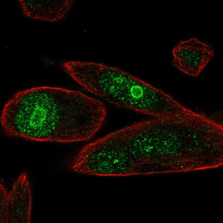 Immunocytochemistry/ Immunofluorescence - Anti-PHLDA1 antibody (AB244526)