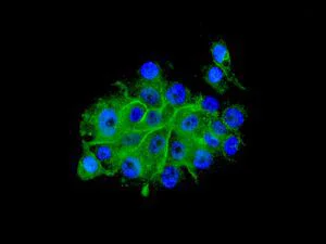 Immunocytochemistry/ Immunofluorescence - Anti-PHLDA1 antibody [EPR6674] (AB133654)