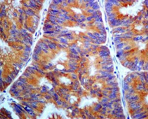 Immunohistochemistry (Formalin/PFA-fixed paraffin-embedded sections) - Anti-PHLDA1 antibody [EPR6674] (AB133654)