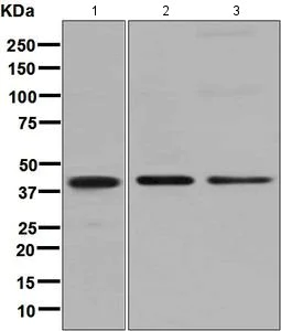 Western blot - Anti-PHLDA1 antibody [EPR6674] (AB133654)