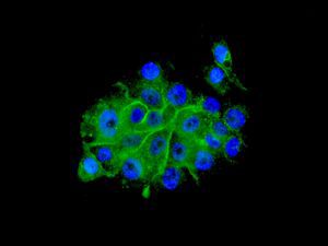 Immunocytochemistry/ Immunofluorescence - Anti-PHLDA1 antibody [EPR6674] - BSA and Azide free (AB240076)