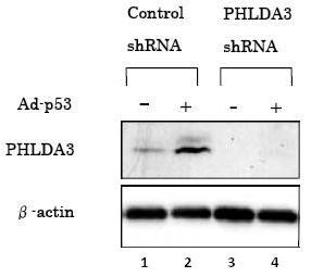 Western blot - Anti-PHLDA3 antibody [4B6] (AB81464)