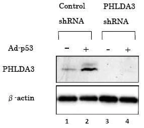 Western blot - Anti-PHLDA3 antibody [4B6] (AB81464)
