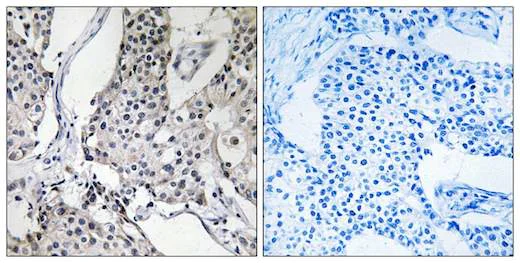 Immunohistochemistry (Formalin/PFA-fixed paraffin-embedded sections) - Anti-PHLDA3 antibody (AB196757)