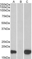 Western blot - Anti-PHLDA3 antibody (AB22822)