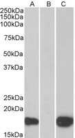 Western blot - Anti-PHLDA3 antibody (AB22822)