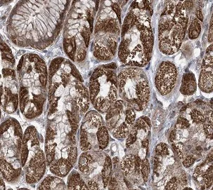 Immunohistochemistry (Formalin/PFA-fixed paraffin-embedded sections) - Anti-PHLDB2 antibody (AB202350)