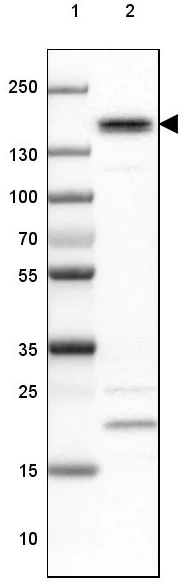 Western blot - Anti-PHLDB2 antibody (AB202350)