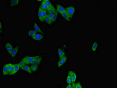Immunocytochemistry/ Immunofluorescence - Anti-PHLDB2 antibody (AB234885)