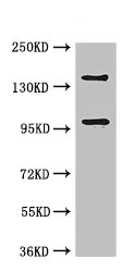 Western blot - Anti-PHLDB2 antibody (AB234885)