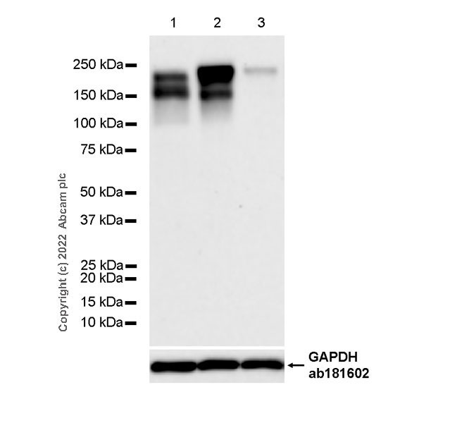 Western blot - Anti-PHLPP1 antibody [EPR27151-55] - BSA and Azide free (AB305296)