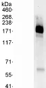 Immunoprecipitation - Anti-PHLPP2 antibody (AB71973)