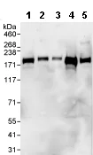 Western blot - Anti-PHLPP2 antibody (AB71973)