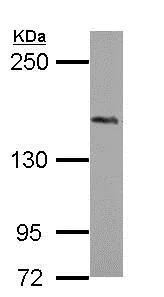Western blot - Anti-PHLPP2 antibody - N-terminal (AB153918)