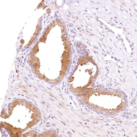Immunohistochemistry (Formalin/PFA-fixed paraffin-embedded sections) - Anti-PHLPP2 antibody [SP220] (AB227673)