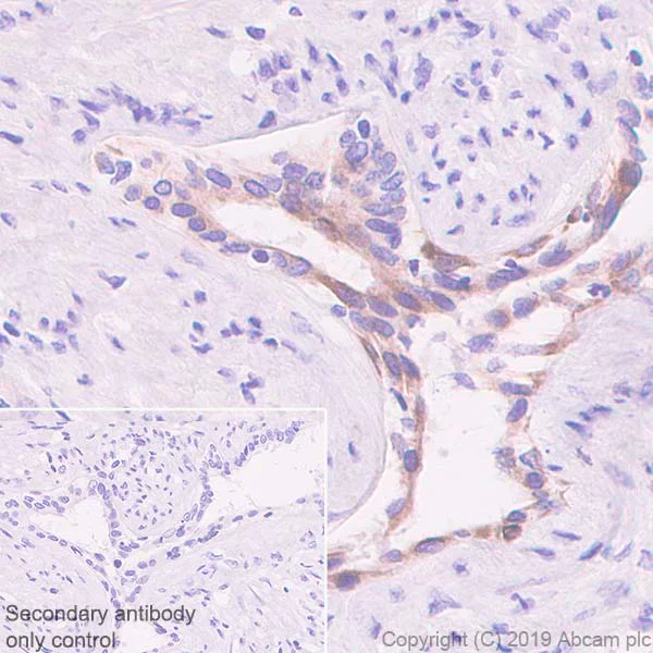 Immunohistochemistry (Formalin/PFA-fixed paraffin-embedded sections) - Anti-PHLPP2 antibody [SP220] (AB227673)