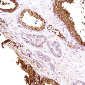 Immunohistochemistry (Formalin/PFA-fixed paraffin-embedded sections) - Anti-PHLPP2 antibody [SP220] (AB227673)