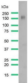 Western blot - Anti-PHLPP2 antibody [SP220] (AB227673)