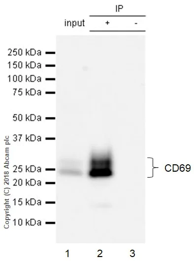 Immunoprecipitation - Phorbol 12-myristate 13-acetate (PMA), PKC activator (AB120297)