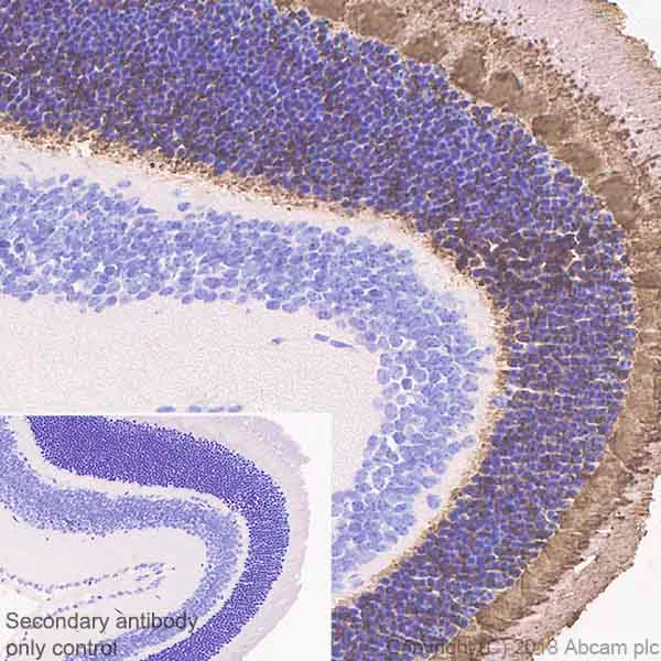 Immunohistochemistry (Formalin/PFA-fixed paraffin-embedded sections) - Anti-PHOS/PDC antibody [EPR21913] (AB221138)