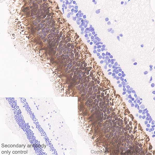Immunohistochemistry (Formalin/PFA-fixed paraffin-embedded sections) - Anti-PHOS/PDC antibody [EPR21913] (AB221138)
