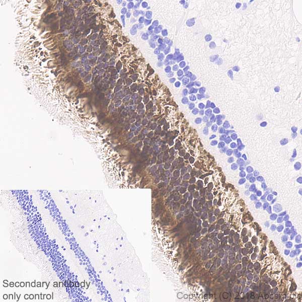 Immunohistochemistry (Formalin/PFA-fixed paraffin-embedded sections) - Anti-PHOS/PDC antibody [EPR21913] - BSA and Azide free (AB234531)
