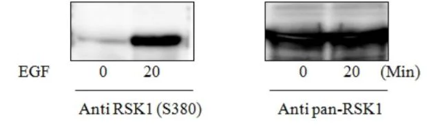 Sandwich ELISA - Phosph-RSK1 p90 (S380) ELISA Kit (AB279914)