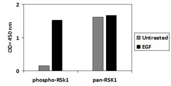 Sandwich ELISA - Phosph-RSK1 p90 (S380) ELISA Kit (AB279914)