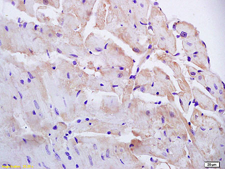 Immunohistochemistry (Formalin/PFA-fixed paraffin-embedded sections) - Anti-Phosphatidic acid phosphatase type 2B antibody (AB203216), expandable thumbnail