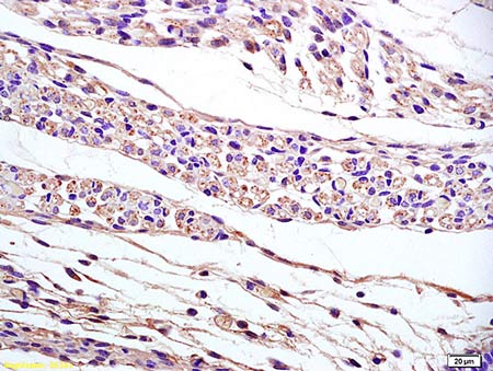 Immunohistochemistry (Formalin/PFA-fixed paraffin-embedded sections) - Anti-Phosphatidic acid phosphatase type 2B antibody (AB203216), expandable thumbnail