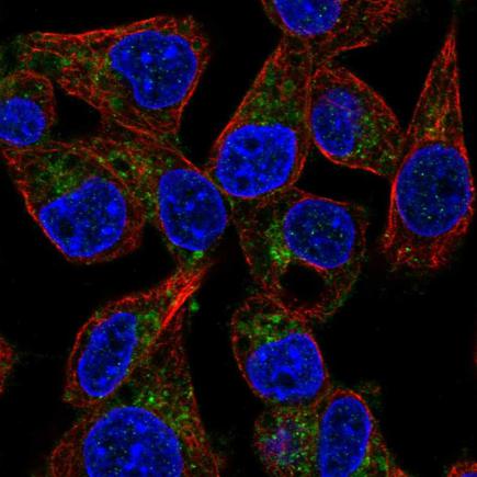 Immunocytochemistry/ Immunofluorescence - Anti-Phosphatidic acid phosphatase type 2B antibody (AB221918), expandable thumbnail