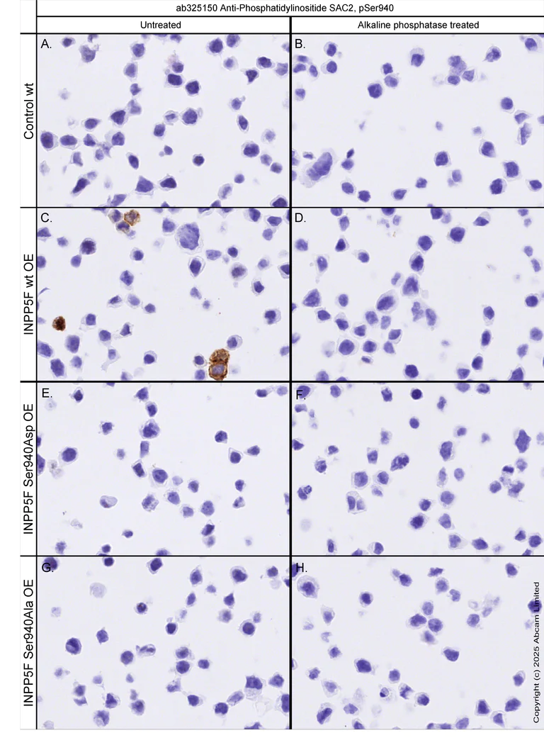 Immunohistochemistry (Formalin/PFA-fixed paraffin-embedded sections) - Anti-Phosphatidylinositide phosphatase SAC2 (phospho S940) antibody [MJF-R31301-10] (AB325150)