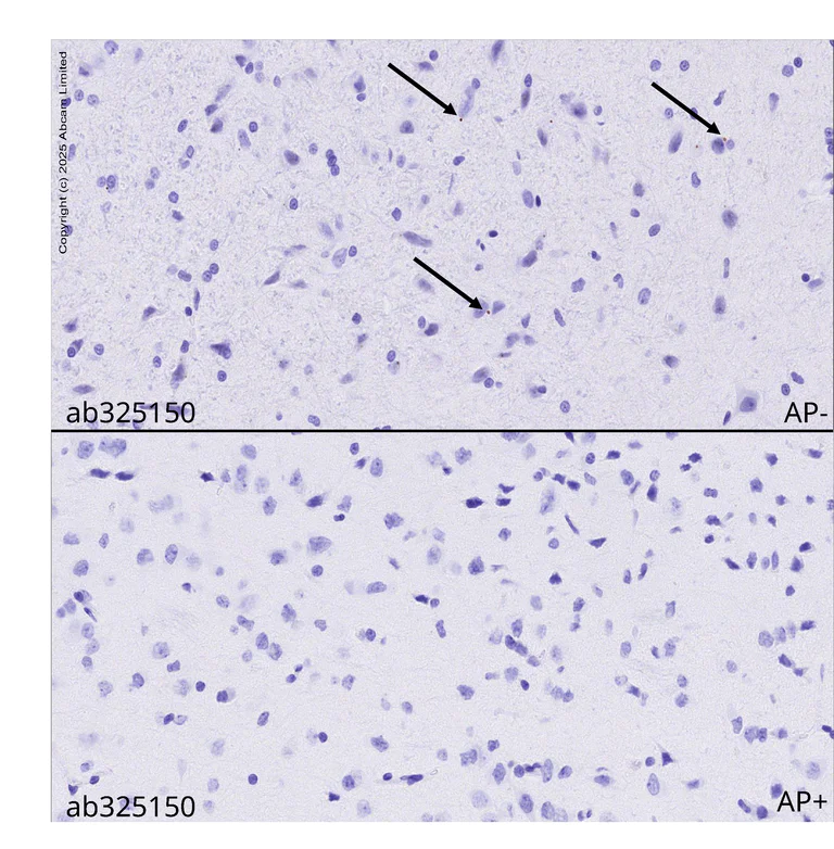 Immunohistochemistry (Formalin/PFA-fixed paraffin-embedded sections) - Anti-Phosphatidylinositide phosphatase SAC2 (phospho S940) antibody [MJF-R31301-10] (AB325150)