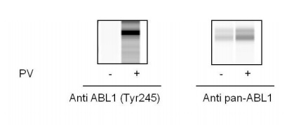 Sandwich ELISA - Phospho-ABL1 (Y245) and Total ABL1 ELISA Kit (AB279728), expandable thumbnail