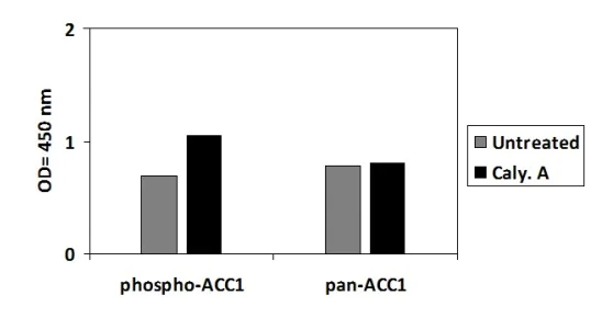 Sandwich ELISA - Phospho-Acetyl Coenzyme A Carboxylase (S79) and Total Acetyl Coenzyme A Carboxylase ELISA Kit (AB279730)