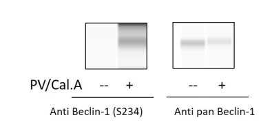Sandwich ELISA - Phospho-Beclin 1 (S234) ELISA Kit (AB279747)