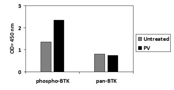 Sandwich ELISA - Phospho-BTK (Y551) and Total BTK ELISA Kit (AB279753), expandable thumbnail