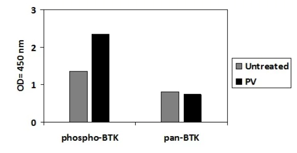 Sandwich ELISA - Phospho-BTK (Y551) ELISA Kit (AB279751)