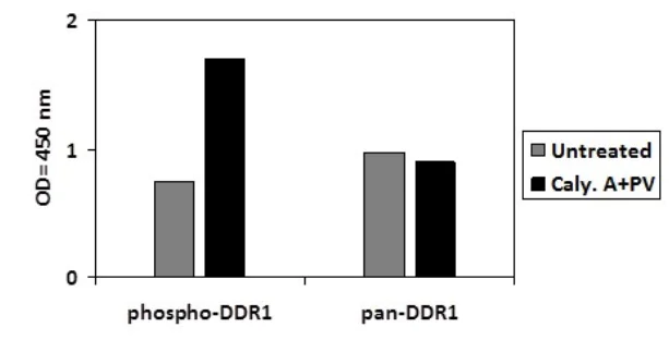 Sandwich ELISA - Phospho-CD167a/DDR1 (Y792) and Total CD167a/DDR1 ELISA Kit (AB279769)