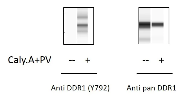 Sandwich ELISA - Phospho-CD167a/DDR1 (Y792) ELISA Kit (AB279768)
