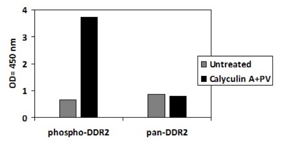 Sandwich ELISA - Phospho-DDR2 (Y740) and Total DDR2 ELISA Kit (AB279771), expandable thumbnail