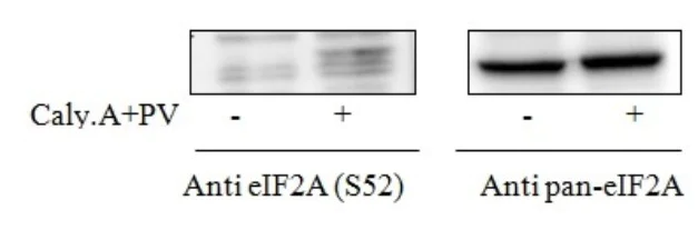 Sandwich ELISA - Phospho-EIF2S1 (S52) and Total EIF2S1 ELISA Kit (AB279775)