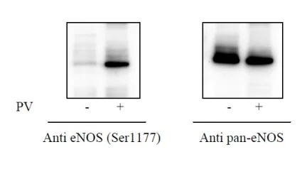 Sandwich ELISA - Phospho-eNOS (S1177) and Total eNOS ELISA Kit (AB279779)