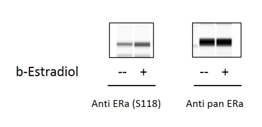 Sandwich ELISA - Phospho-Estrogen receptor alpha (Ser118) ELISA Kit (AB279786)