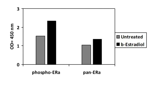 Sandwich ELISA - Phospho-Estrogen receptor alpha (Ser118) ELISA Kit (AB279786)
