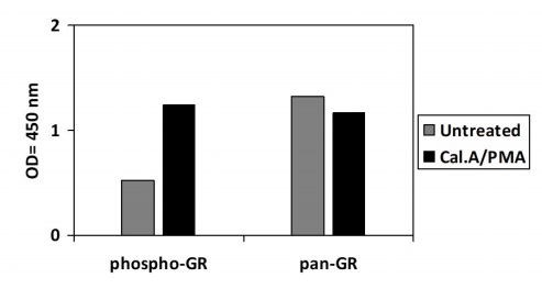 Sandwich ELISA - Phospho-Glucocorticoid Receptor (S226) ELISA Kit (AB279810)