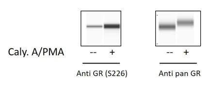 Sandwich ELISA - Phospho-Glucocorticoid Receptor (S226) ELISA Kit (AB279810)