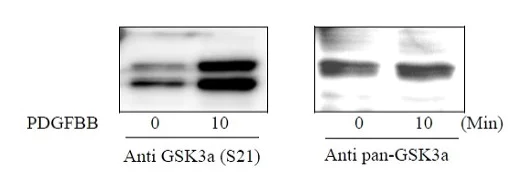 Sandwich ELISA - Phospho-GSK3 alpha (S21) and Total GSK3 alpha ELISA Kit (AB279813)