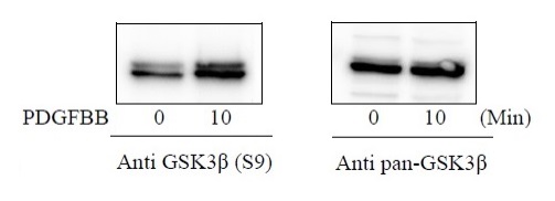 Sandwich ELISA - Phospho-GSK3 beta (S9) ELISA Kit (AB279814), expandable thumbnail